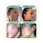 Skin & Digestion Balance Duo