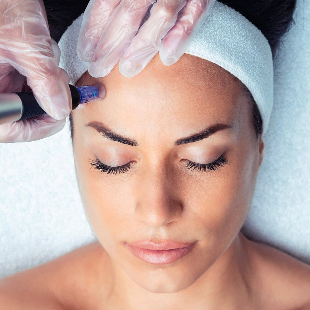 Trattamento Skin Booster