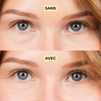 Dúo • Tratamiento Con Color Antiojeras (Previa) + Crema Hidratante Bb Spf20