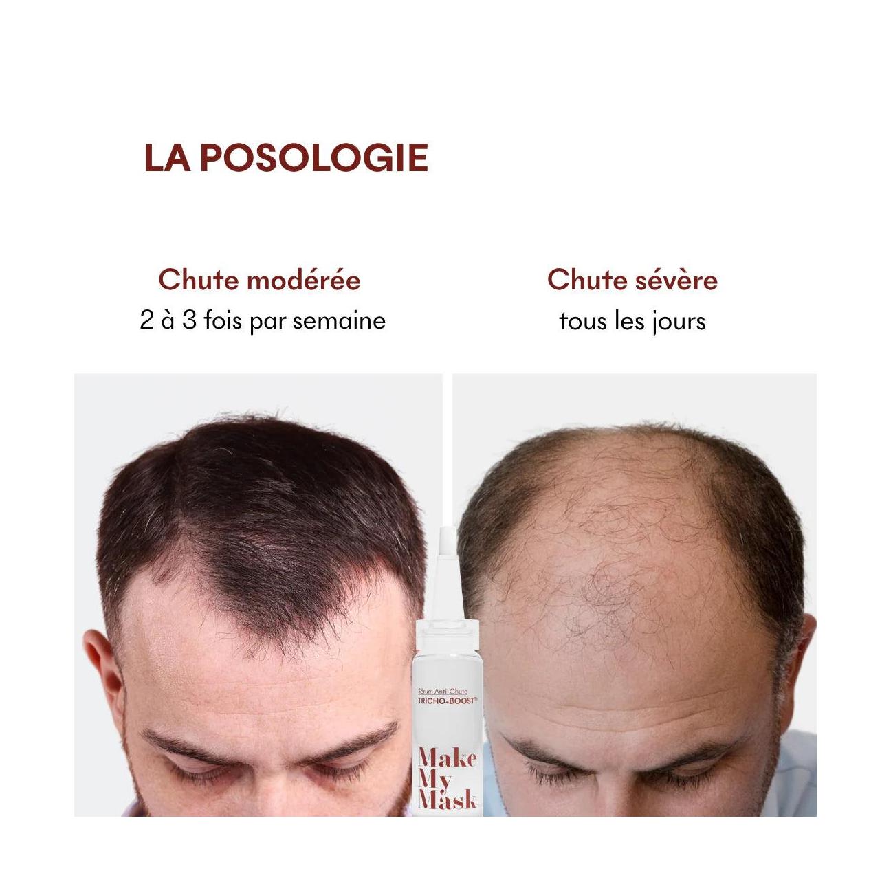 Sérum Anti-Chute Tricho-Boost