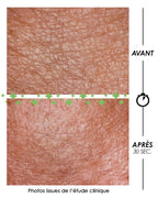Macro close-up of a Garancia clinical study showing skin texture before and after 30 seconds of using Pschitt Magique. The skin relief is visibly smoothed and pores are tightened.