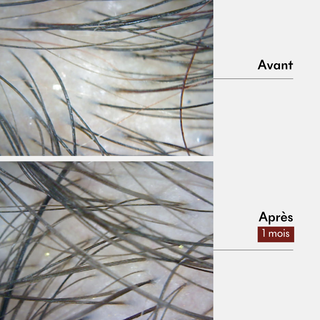 Growth & Anti-Hair Loss Mud