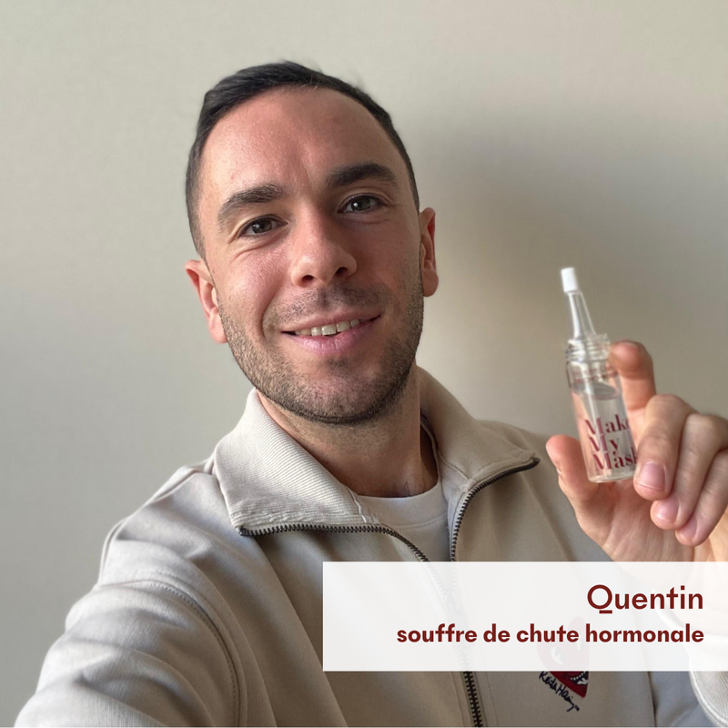 Protocole Anti-Chute Hormonale