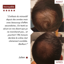 serum_anti_chute_avant_apres_julien_makemymask.png__PID:e9203d6f-fede-455c-9d3a-9ebbdde8e489