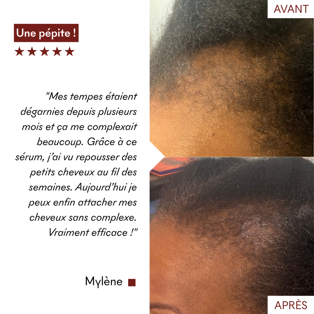 Anti-Hair Loss Serum Tricho-Boost