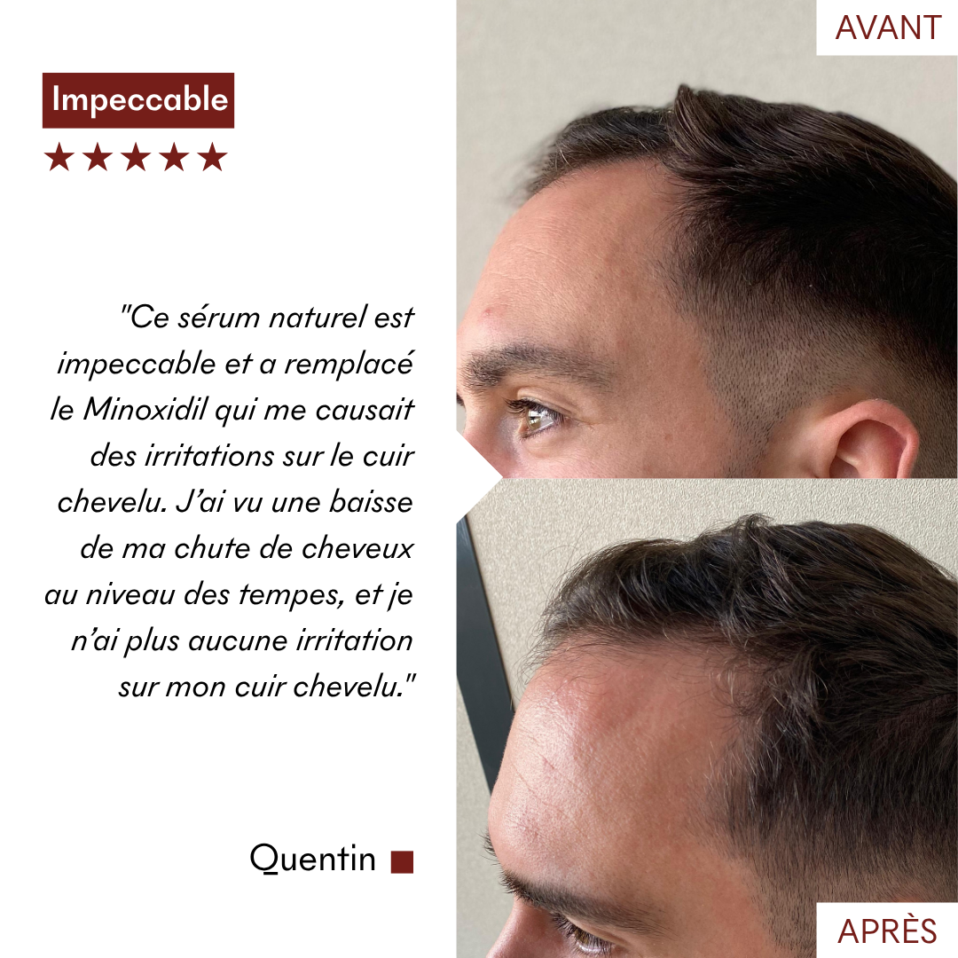 Anti-Hair Loss Serum Tricho-Boost