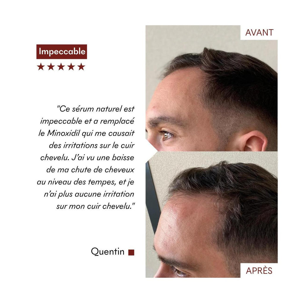Sérum Anti-Chute Tricho-Boost