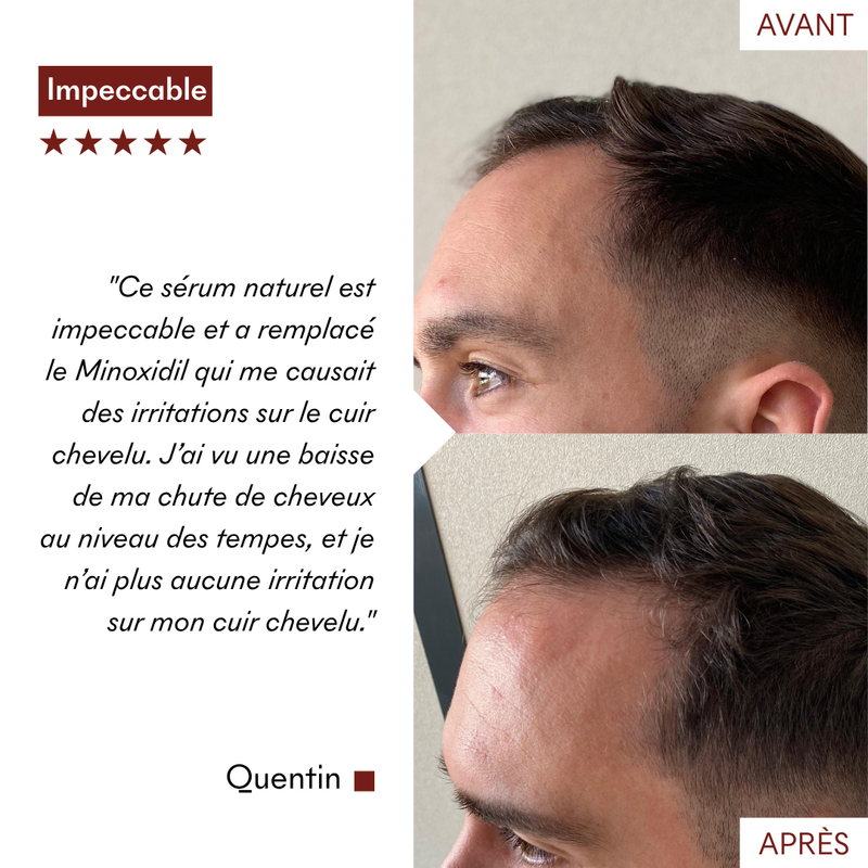 Protocole Anti-Chute Tricho-Boost