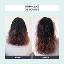 Complejo de Crecimiento - D-Lab - The Bradery