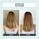 Complejo de Crecimiento - D-Lab - The Bradery