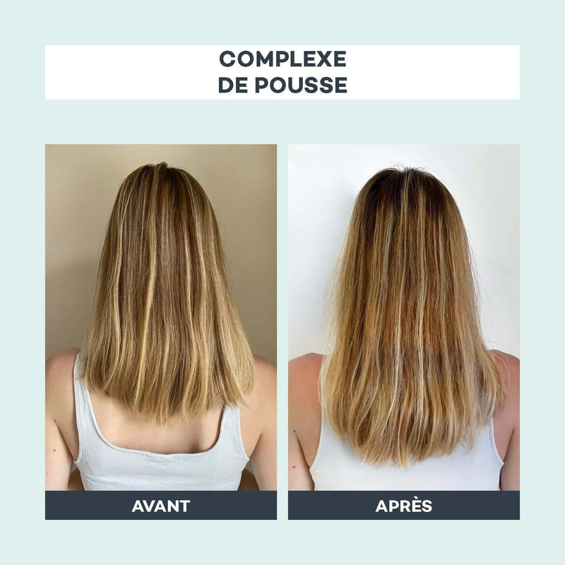 Complejo de Crecimiento - D-Lab - The Bradery