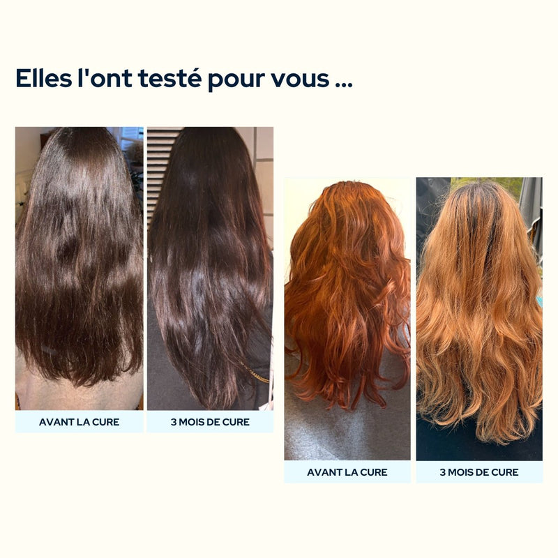 Cure Essentiel cheveux & ongles - Epycure